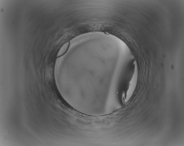 X0000062150035200601061000