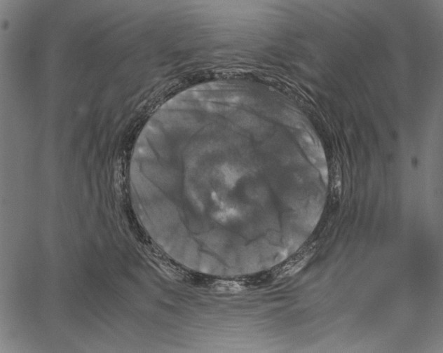 X0000062150519200601060952