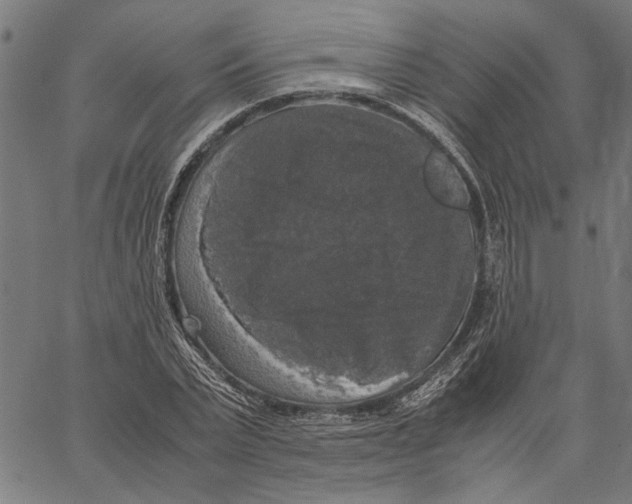 X0000062150783200601060948