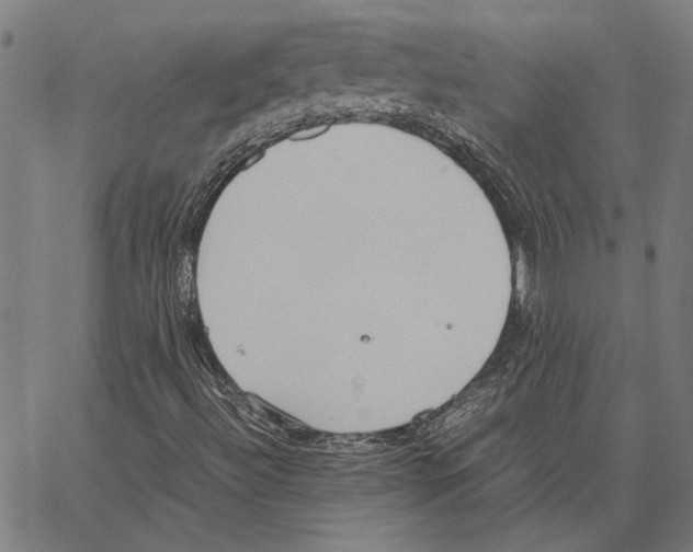 X0000062151492200601060935