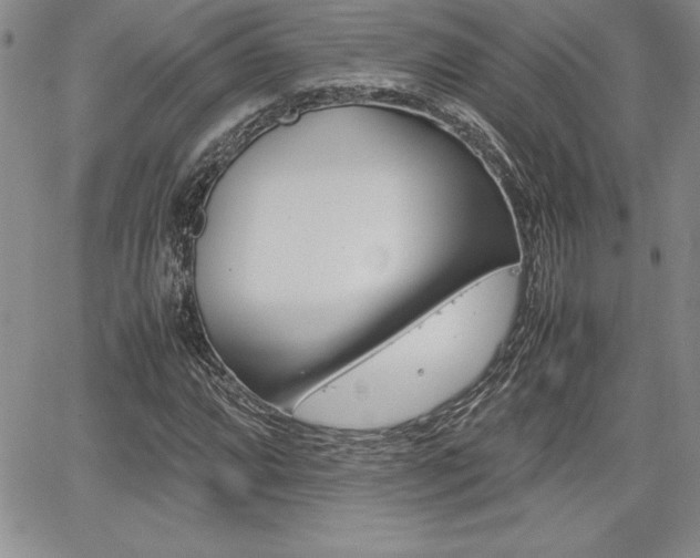 X0000062171064200512091045