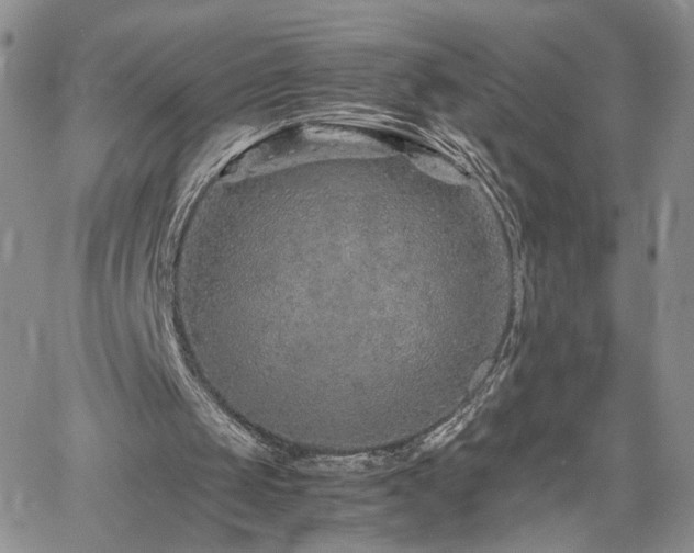 X0000062170049200512091440