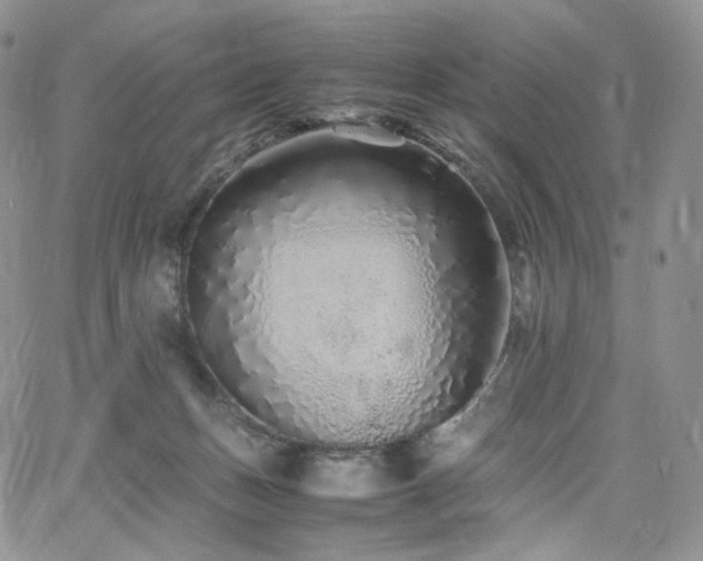 X0000062170175200512091439