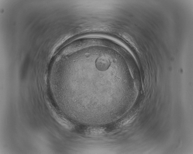 X0000062170491200512091434