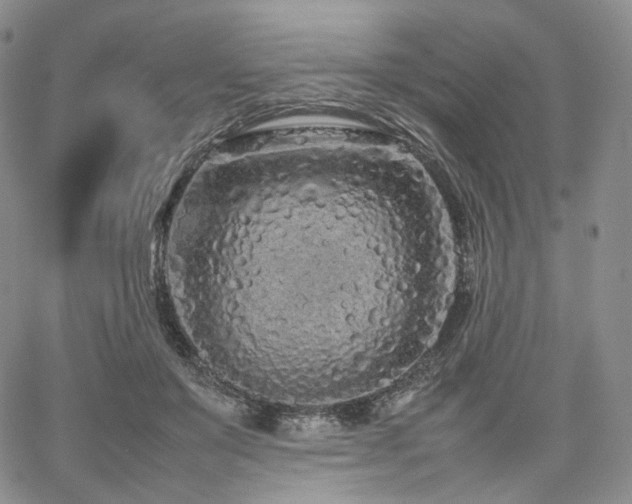 X0000062170503200512091433