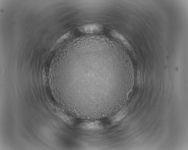 X0000062170569200512091433