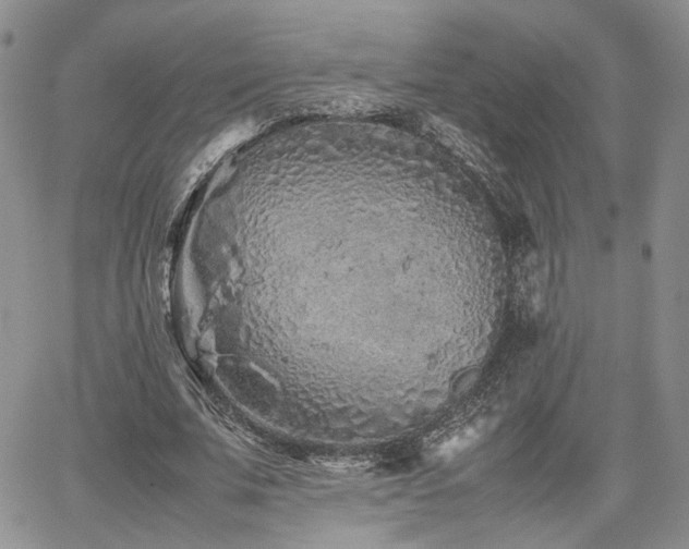 X0000062170679200512091431