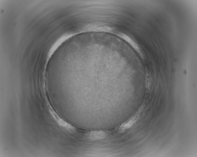 X0000062171094200512091424