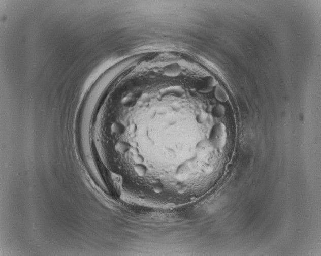 X0000062171179200512091422