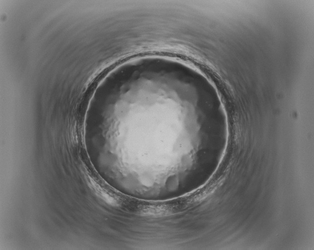 X0000062171497200512091417