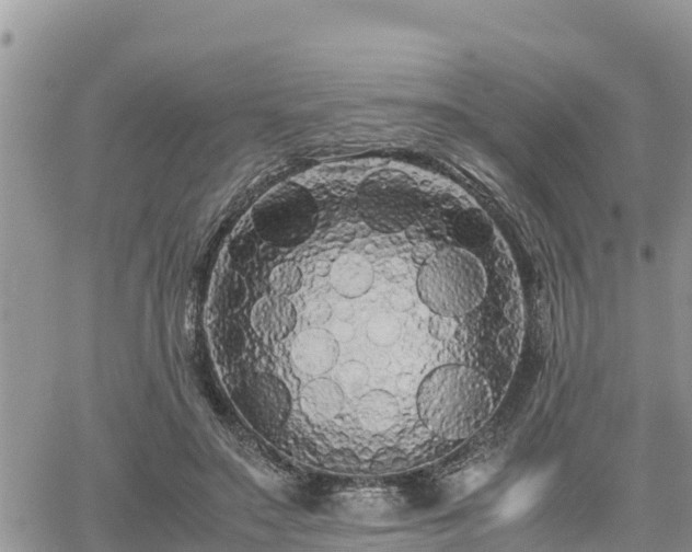 X0000062170499200512121244