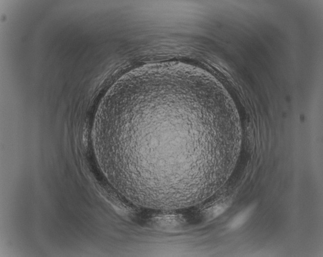 X0000062170499200512161255