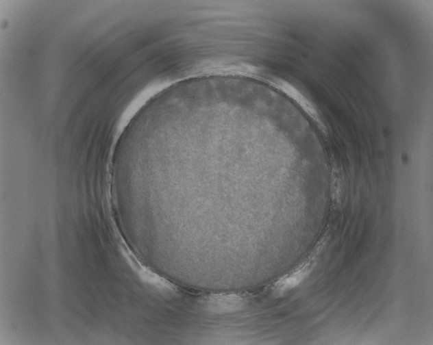 X0000062171094200512161245