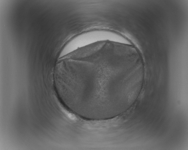 X0000062170009200512231638