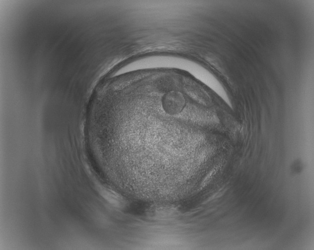 X0000062170491200512231630