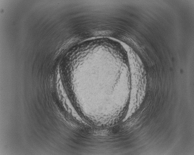X0000062170357200601061047