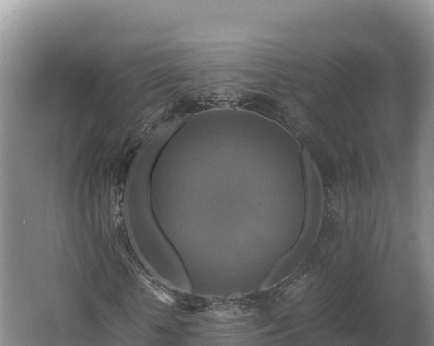 X0000062620818200512230944