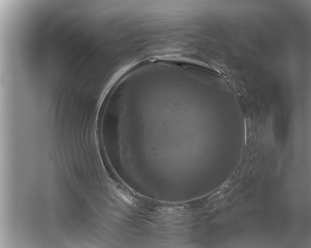 X0000062620147200512281538