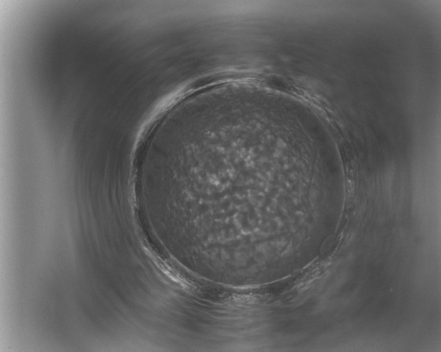 X0000062620149200512281538