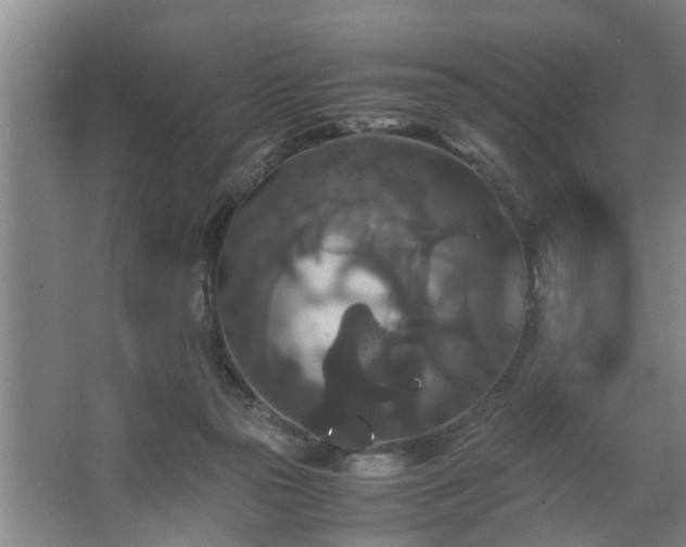 X0000062620169200512281539