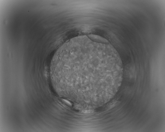 X0000062620135200601041015