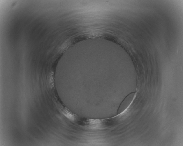 X0000062620144200601041015