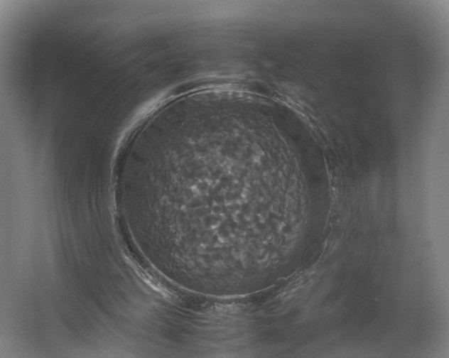 X0000062620149200601041014