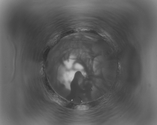 X0000062620169200601041014