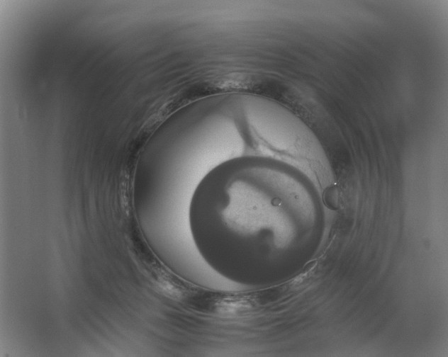 X0000062620175200601041014