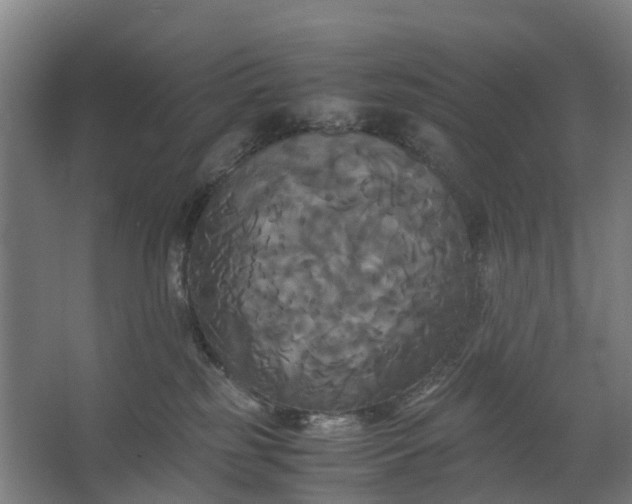 X0000062620185200601041015