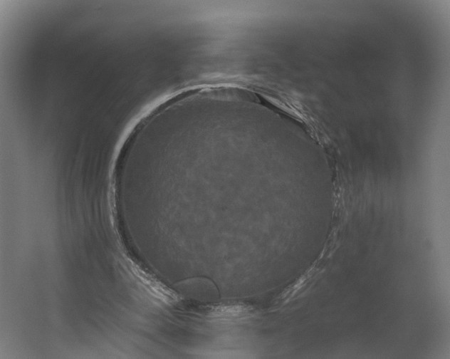 X0000062620342200601041011