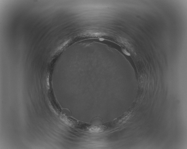 X0000062620358200601041011