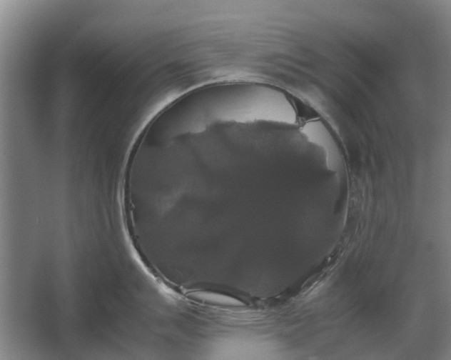 X0000062621007200601041000