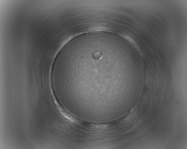 X0000062621039200601041000