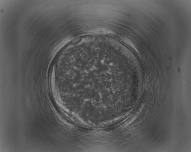 X0000062621087200601111028