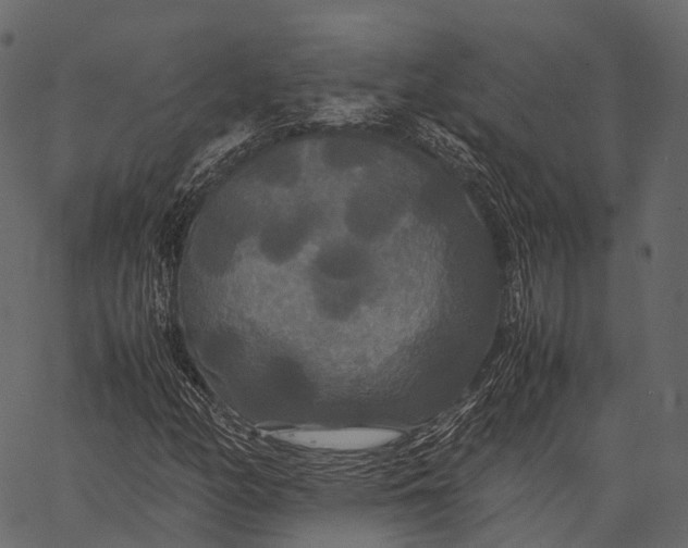 X0000062621158200601111027