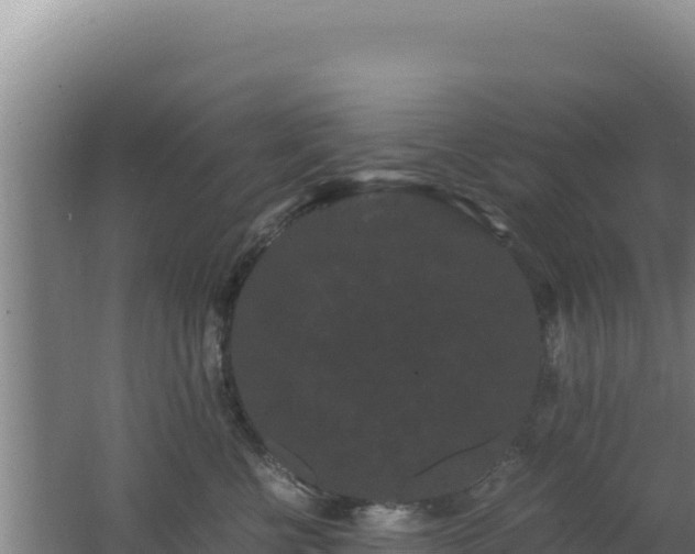 X0000062630570200512231017