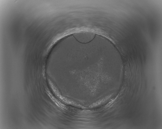 X0000062631499200601041017