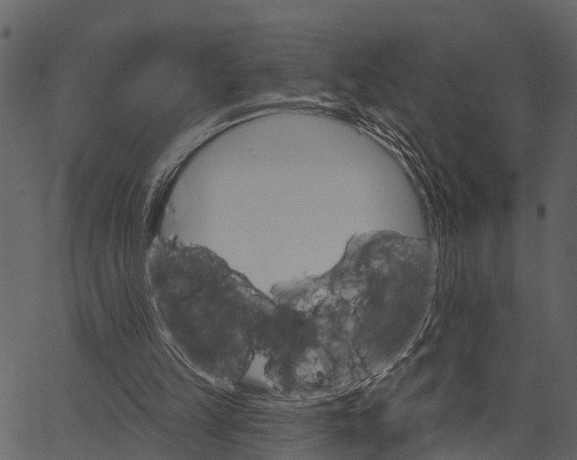 X0000062640149200601111135