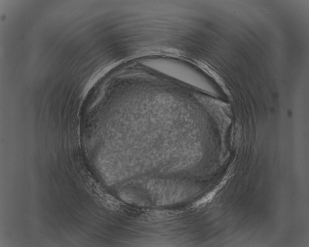 X0000062640877200601111123