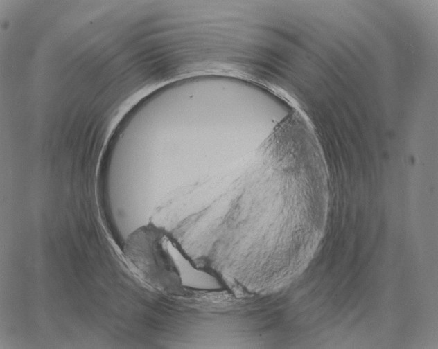 X0000062641125200601181738