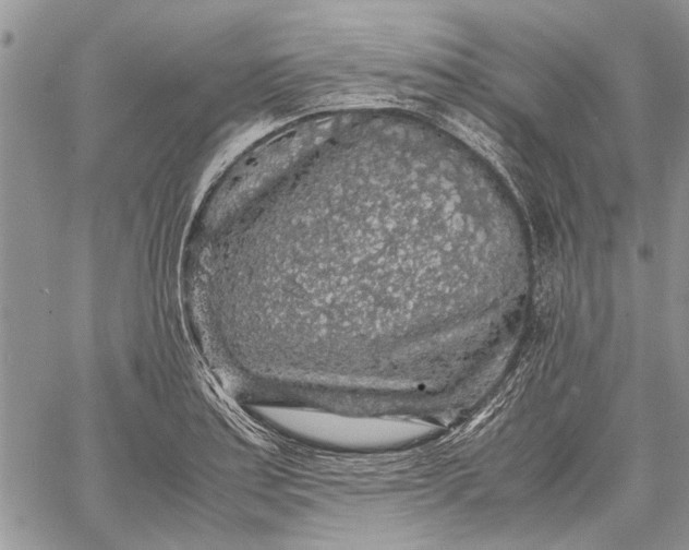 X0000062651179200601040910