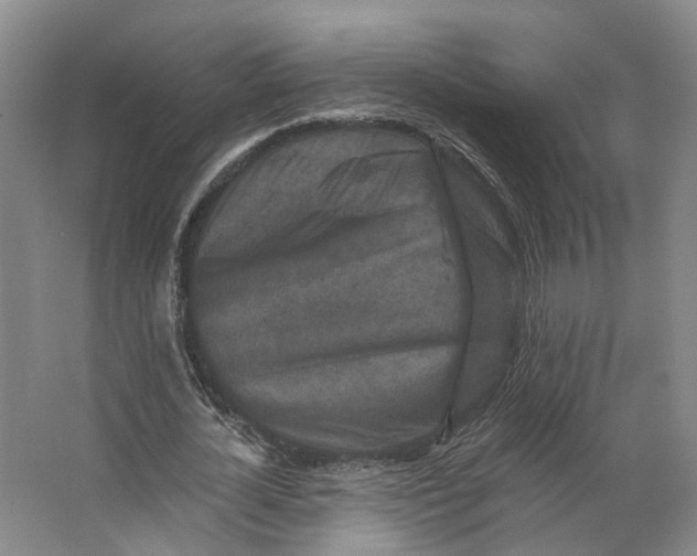 X0000062790724200601051045