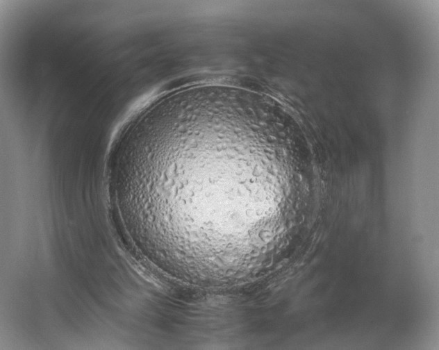 X0000062800149200601051121