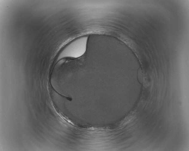 X0000062800434200601051116