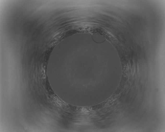 X0000062801013200601051106