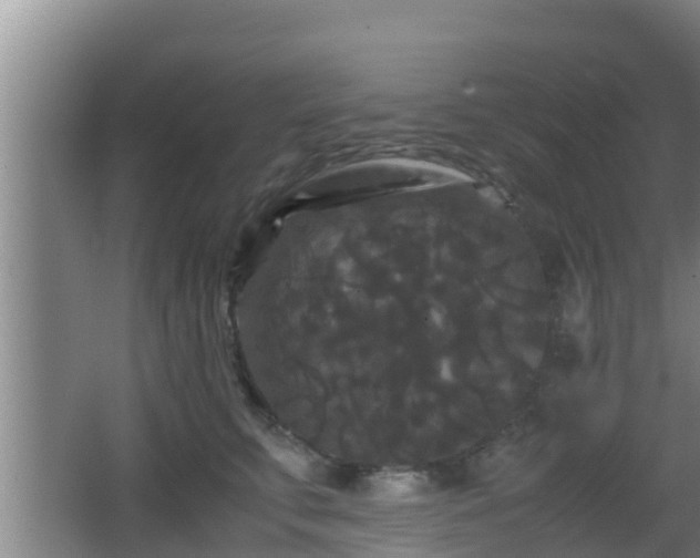 X0000062830711200601171419