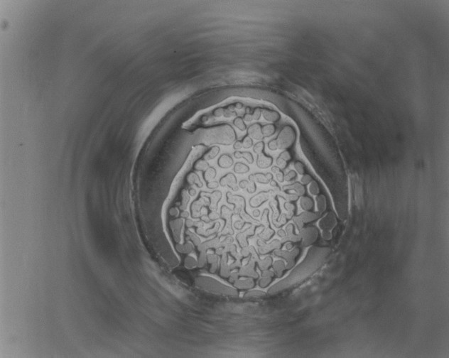 X0000062840147200601272025