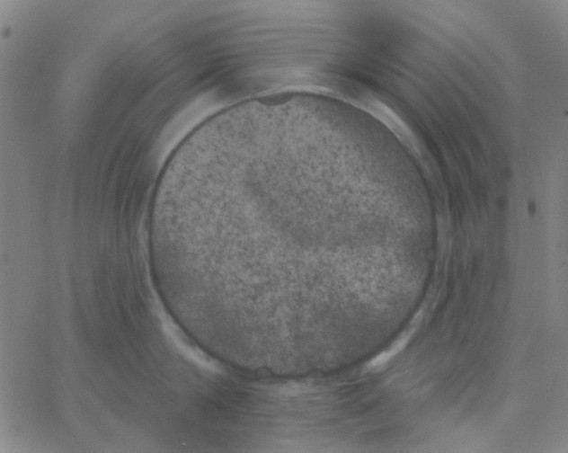 X0000062840814200601272014