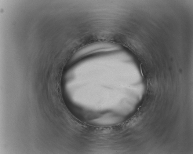 X0000062840817200601272014